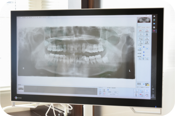 ユニットモニタ